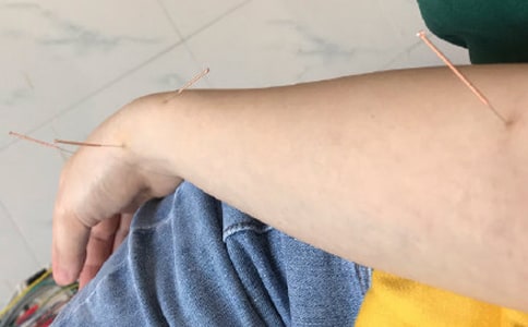 最新針灸科年終工作總結(jié)